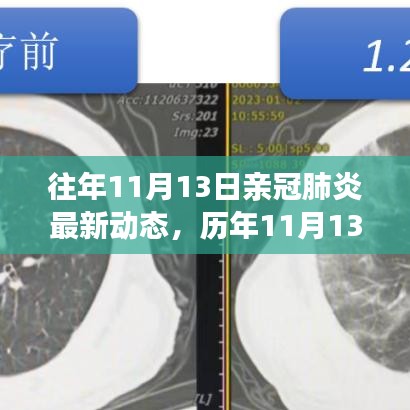 歷年11月13日新冠肺炎動(dòng)態(tài)回顧，最新進(jìn)展、當(dāng)前動(dòng)態(tài)與未來展望