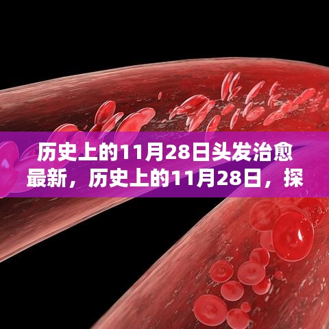 歷史上的11月28日，探尋頭發(fā)治愈的最新篇章??