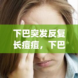 下巴突發(fā)反復(fù)長(zhǎng)痘痘，下巴突發(fā)性長(zhǎng)痘 