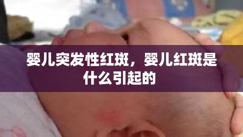 嬰兒突發(fā)性紅斑，嬰兒紅斑是什么引起的 