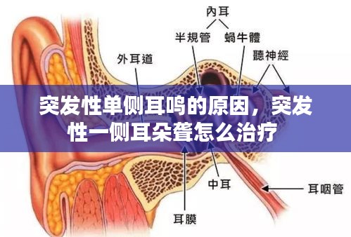 突發(fā)性單側(cè)耳鳴的原因，突發(fā)性一側(cè)耳朵聾怎么治療 